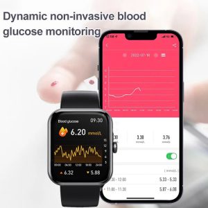 Masimo Blood Oxygen, Heart Rate, Blood Pressure Monitor Watch