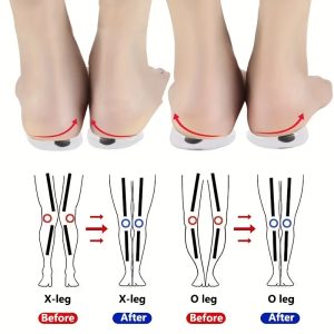 Likron Arch Support Silicone Gel Insoles for Heel Alignment and Foot Comfort
